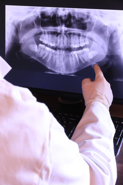 Tooth Infection Emergency Dentist in OR