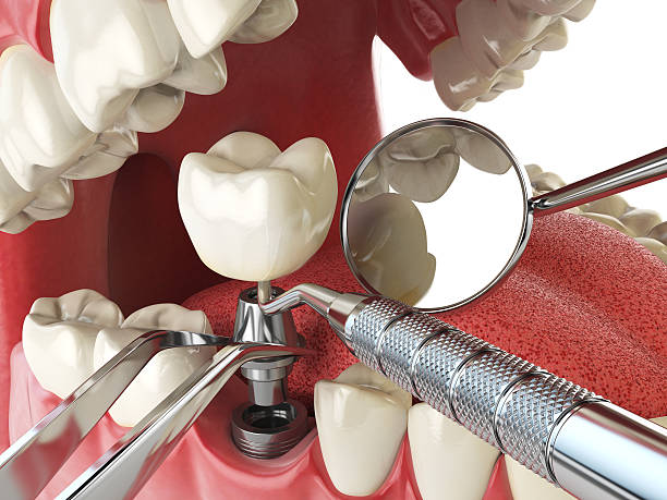 Best Dentist for Severe Toothache  in John Day, OR